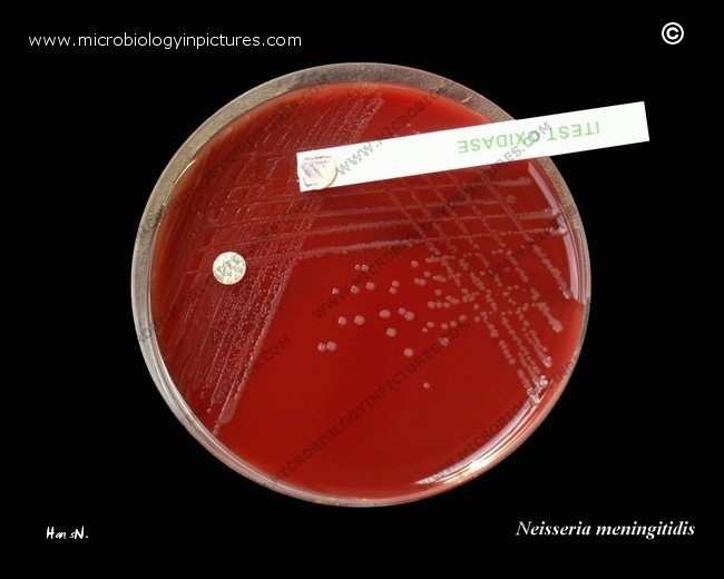 neisseria meningitidis on BAP, oxidase test